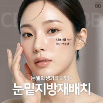 눈밑지방재배치 다크서클 개선도 함께
